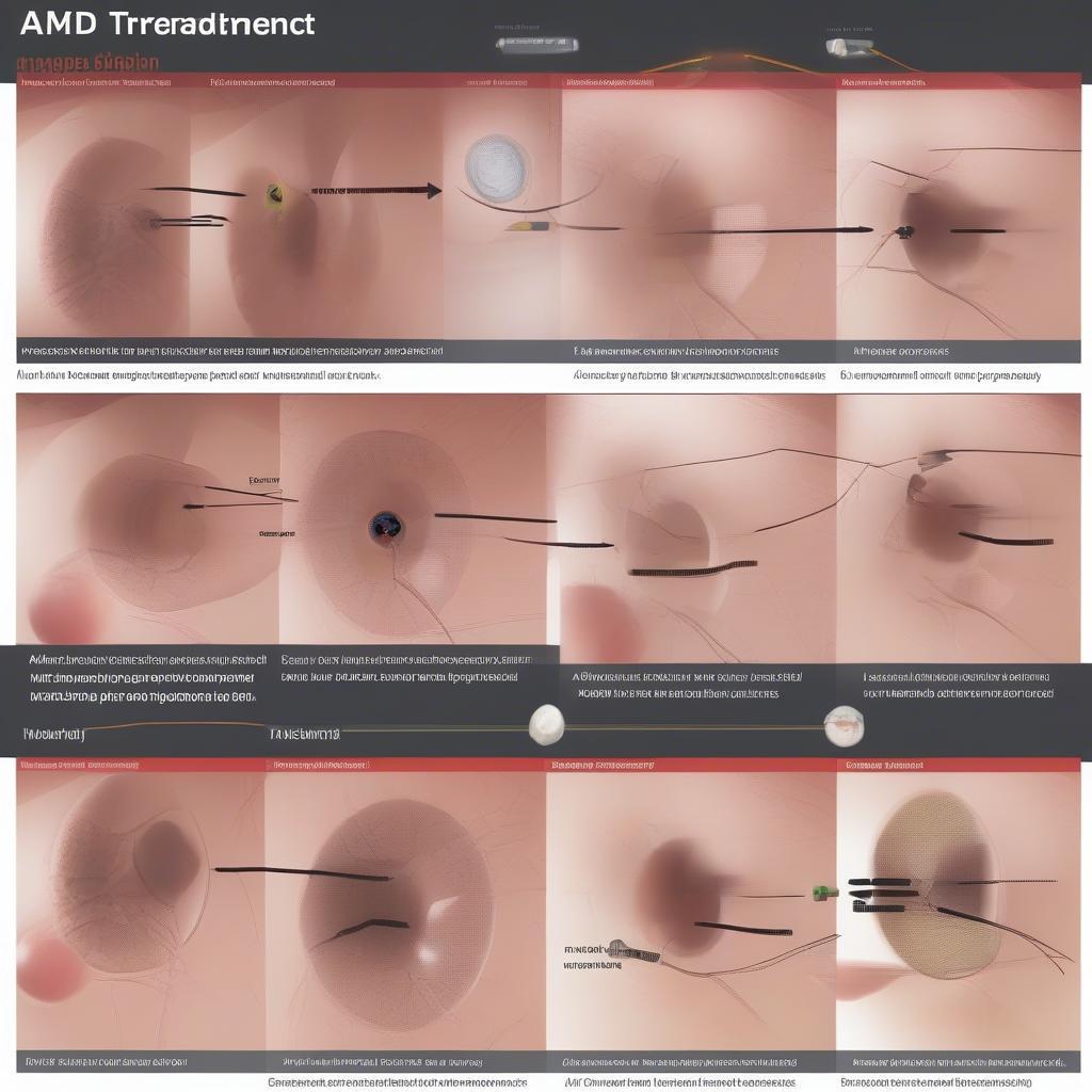 Điều trị AMD khô và ướt