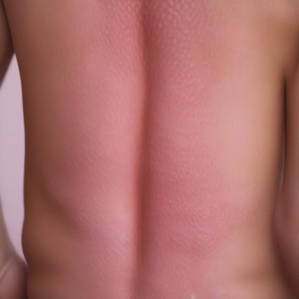 Triệu chứng Bệnh Vẩy Phấn Hồng Gibert